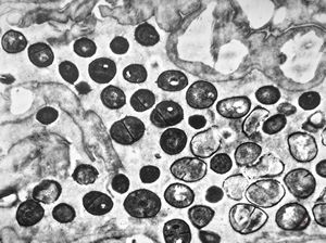 M,39y. | skin - folliculitis